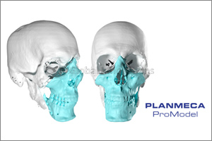 A Face Transplant Operation is a Demonstration of Advanced Surgery and High Technology