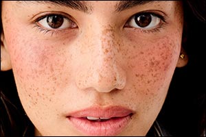 Get the Ultimate Faux Freckles Look with Benefit Cosmetics!